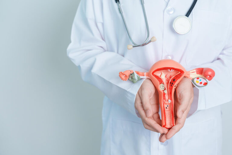 Endometriosis