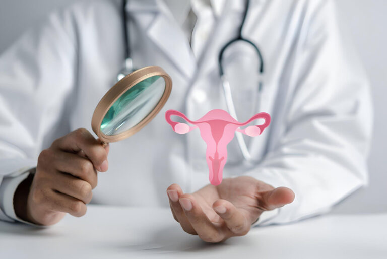 PCOS Management